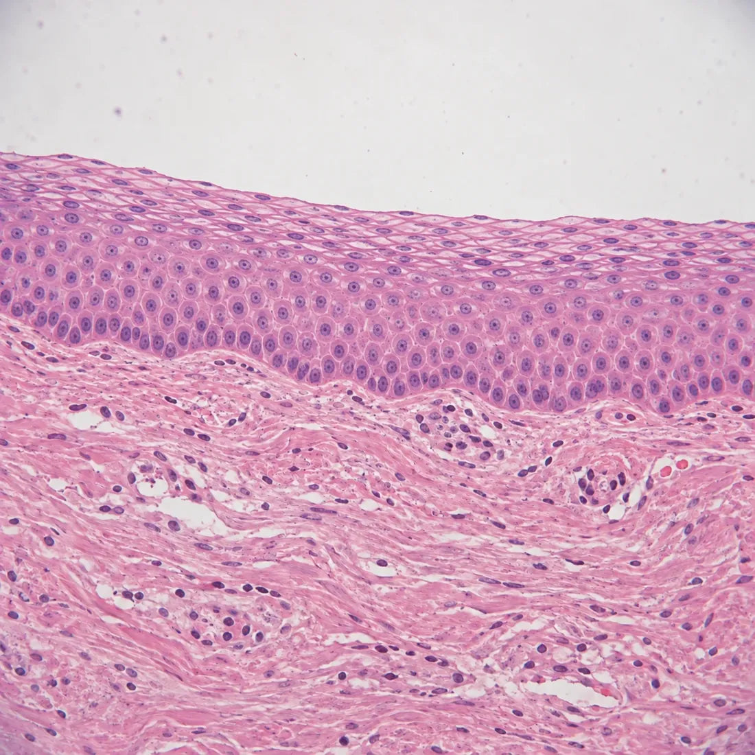 Thick, full vaginal tissue under a microscope, 8 months later